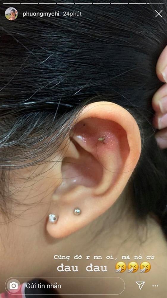 Phương Mỹ Chi bị viêm da khi bấm lỗ tai, những điều này sẽ giúp bạn khắc phục-7