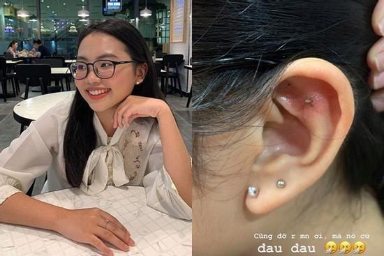 Phương Mỹ Chi bị viêm da khi bấm lỗ tai, những điều này sẽ giúp bạn khắc phục