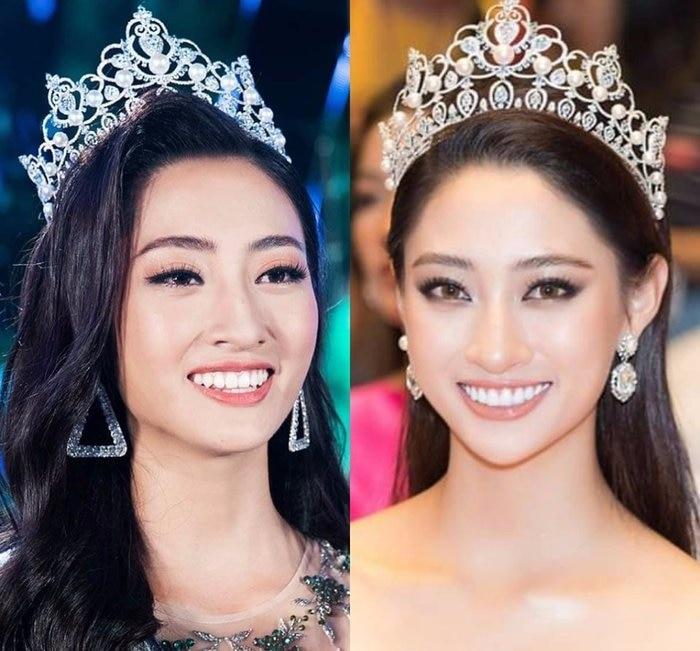 Một thời gian sau đăng quang, Lương Thùy linh vướng nghi án làm lại răng để chinh chiến Miss World.