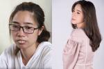 Cô gái Phú Thọ mong tìm được bạn đời sau hành trình phẫu thuật thẩm mỹ