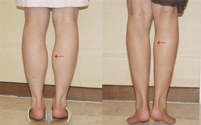 4 nét tướng cực xấu nhưng lại mang tiền về đầy túi cho gia chủ, muốn nghèo cũng khó-2