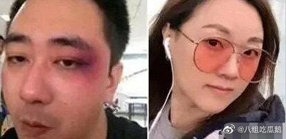 Tài tử Trung Quốc lộ chuyện bị vợ cũ bạo hành-1