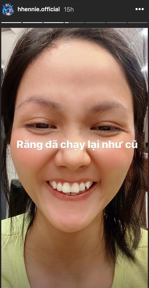 HHen Niê tự tin khoe hàm răng khấp khểnh tranh nhau làm tổ trưởng-3