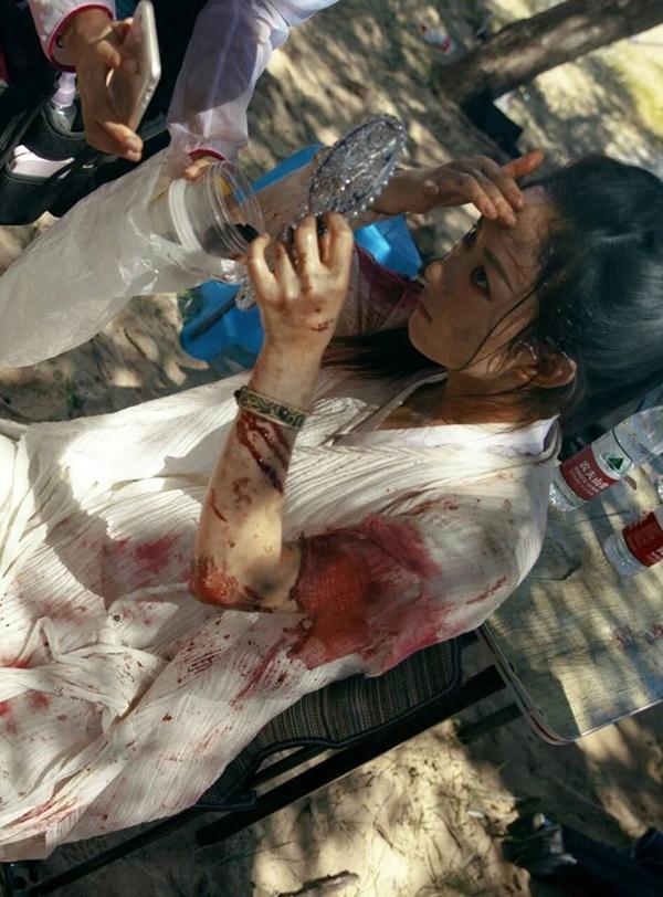 Tai nạn phim trường của Triệu Lệ Dĩnh: Suýt chết đuối cũng chẳng bằng việc sống với cục u suốt đời do ngã ngựa-6