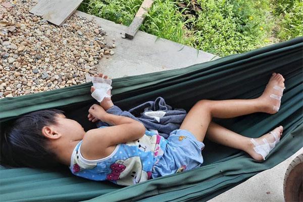 Điều tra vụ cha dượng nghi bạo hành, dí bé 4 tuổi vào pô xe máy ở Tây Ninh-1