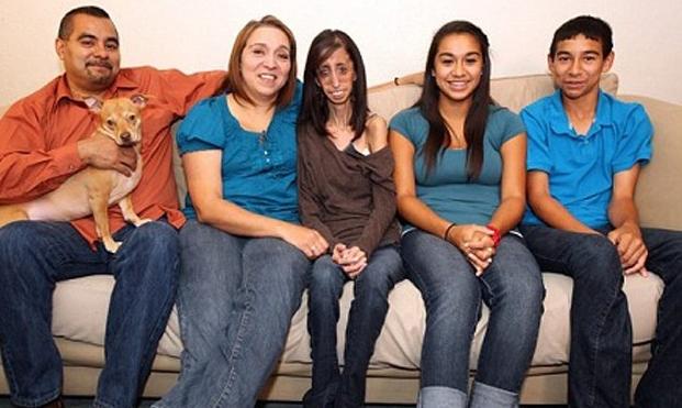 Sau 31 năm, phép màu đã đến với cô gái từng bị gọi xấu xí nhất thế giới-3