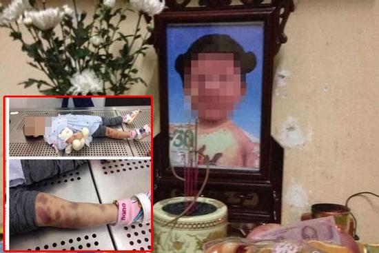 Nghi án bé gái 3 tuổi ở Hà Nội chết thương tâm do bị mẹ đẻ và bố dượng bạo hành như thời trung cổ