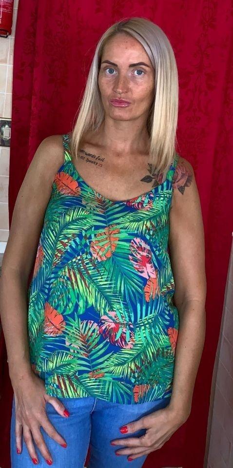 Cô gái bị xanh da vì sử dụng mỹ phẩm hết hạn-1