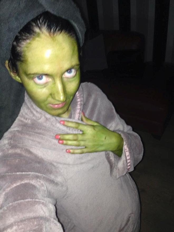 Cô gái bị xanh da vì sử dụng mỹ phẩm hết hạn-2