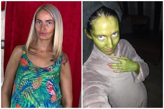 Cô gái bị xanh da vì sử dụng mỹ phẩm hết hạn