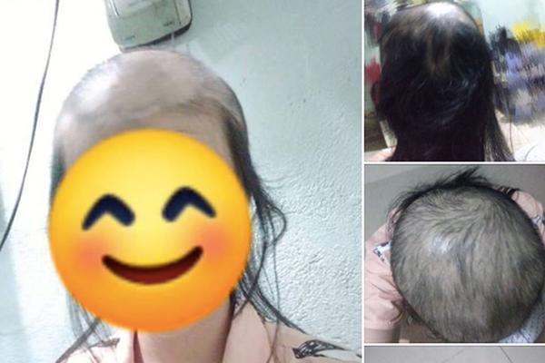 Giảm cân thần tốc, ngoại hình mới nhất của thánh ăn Yang Soo Bin làm nhiều người hoang mang-6