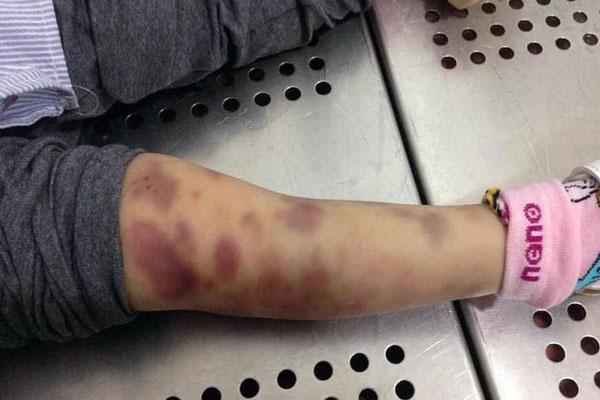 Kẻ bạo hành làm bé gái 3 tuổi tử vong có dấu hiệu giết người-1