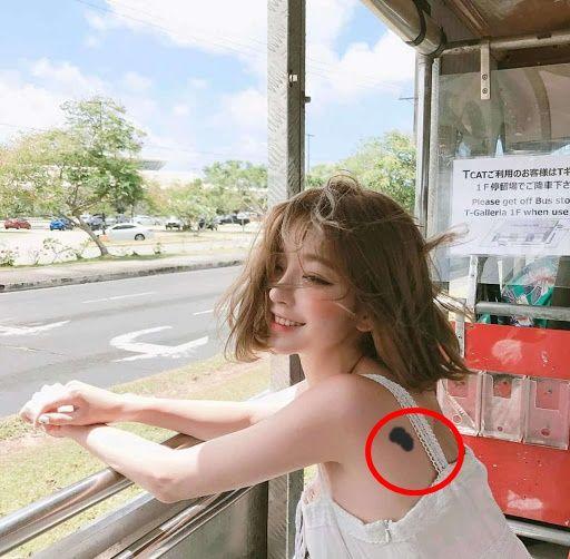 Ý nghĩa theo nhân tướng học của các vết bớt: Bớt ở chân xui xẻo đủ đường-3