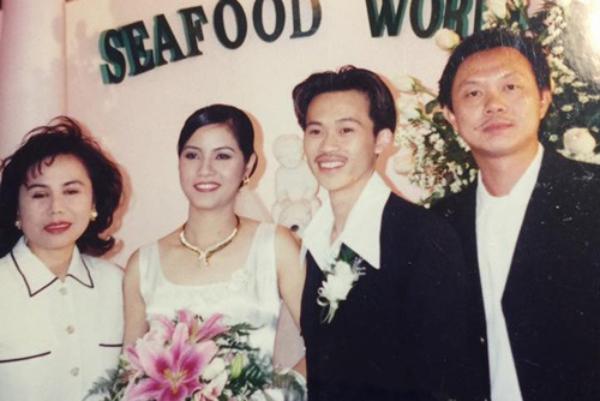 Con trai nuôi Hoài Linh chuẩn bị phẫu thuật sau tai nạn gãy xương hàm-4