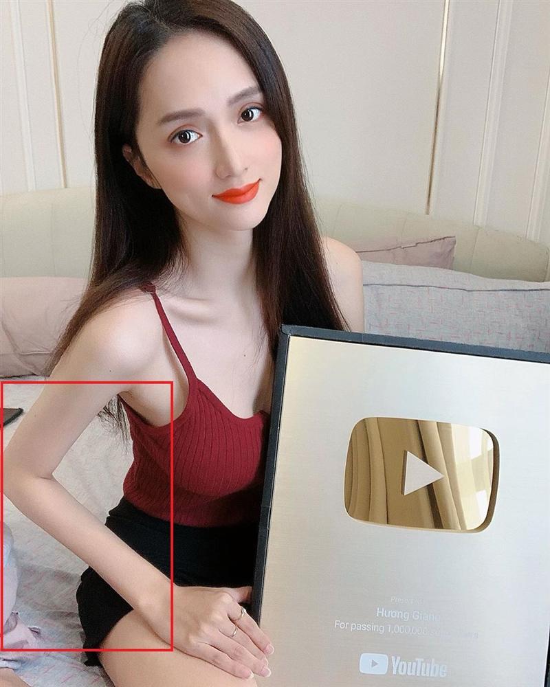 Mải khoe thành tích, hoa hậu Hương Giang nào hay lộ khuyết điểm không thể phẫu thuật-2