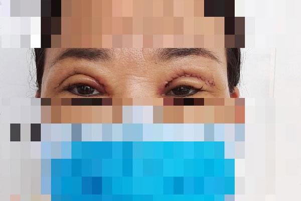 Bố mẹ bỏ quên con trên ô tô giữa trời nắng nóng 40 độ, bé trai 19 tháng suýt chết-2