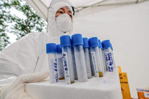 Thêm 1 bệnh nhân tái dương tính Covid-19 sau khi đã xét nghiệm có kết quả âm tính-1