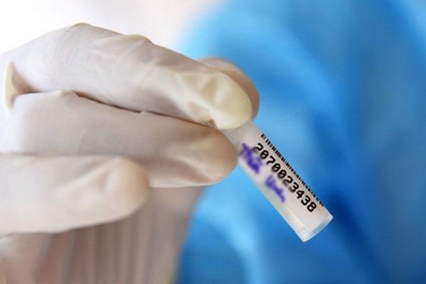 Bắt đua xe, một cảnh sát bị quái xế tông trúng, phải cưa chân-2