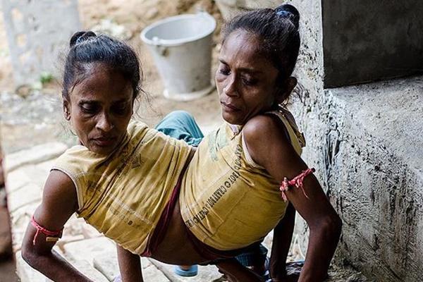 Anh em sinh đôi cưới chị em sinh đôi, chính người trong cuộc cũng bị lú-4