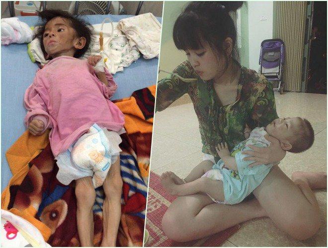 Hình ảnh đáng yêu không ngờ của bé gái suy dinh dưỡng ở Lào Cai sau 4 năm được nhận nuôi-1