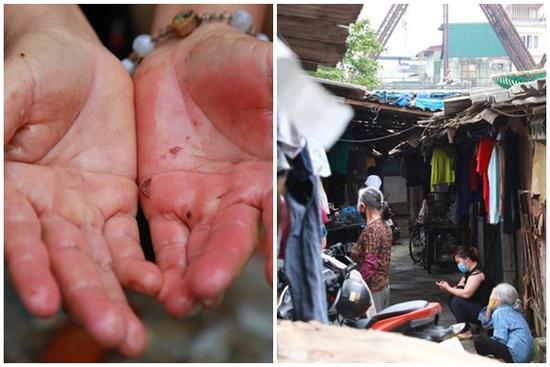 Nỗi niềm những người lao động nghèo chơi vơi giữa Hà Nội vì đại dịch Covid-19: Sống nhờ gạo cứu trợ, cá ươn đi xin