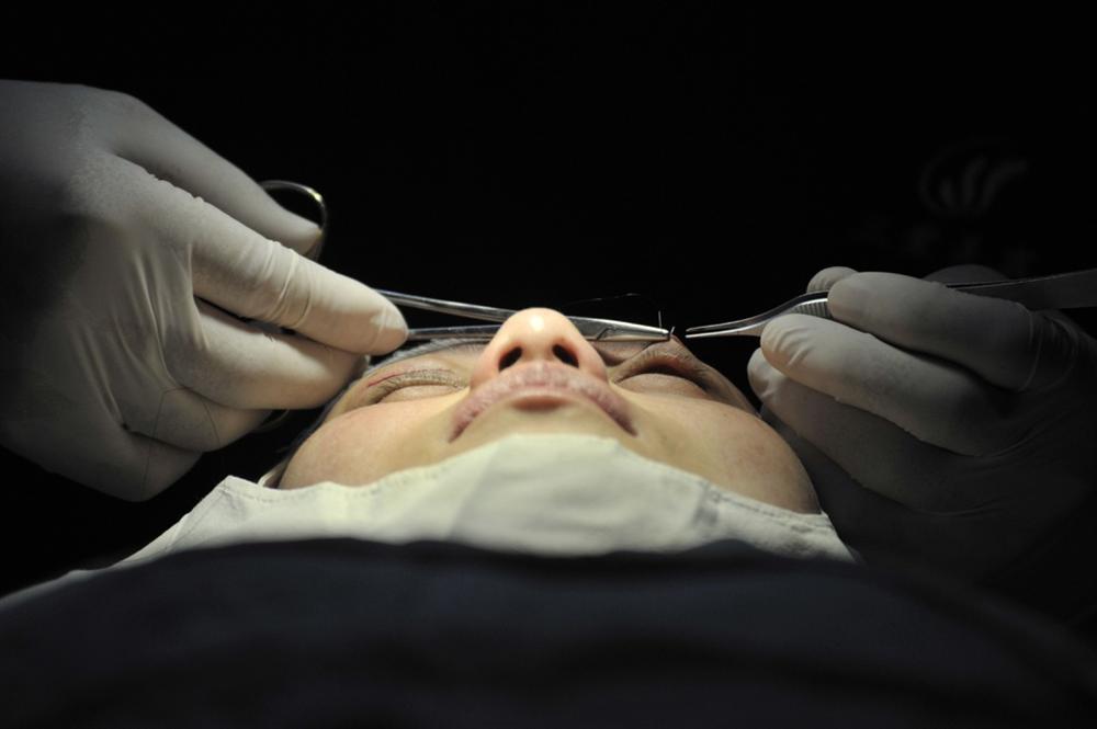 Các cô gái Trung Quốc dao kéo bất chấp hậu quả để kiếm việc, lấy chồng-6