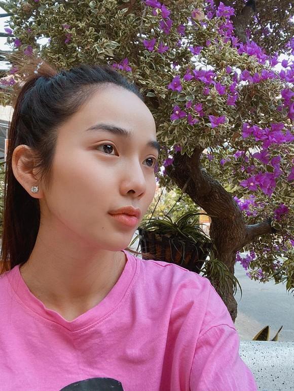 Tiêm filler vào môi, Kim Cương bị Ưng Hoàng Phúc la-2