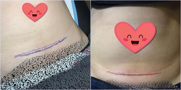 Dàn bố bỉm sữa khiến các mẹ phát cuồng khi xăm chân dung, tattoo sẹo mổ của vợ-1
