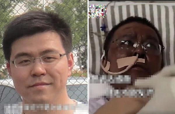 HIỆN TƯỢNG LẠ: Hai bác sĩ nhiễm Covid-19 thoát chết trong gang tấc, tuy nhiên toàn bộ da thịt chuyển sang màu nâu-2