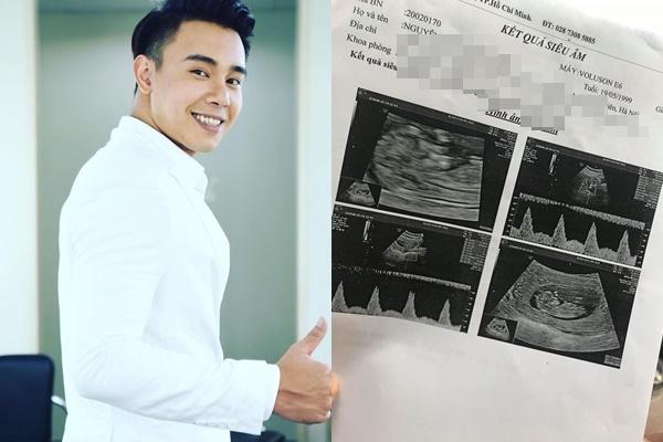 Ca sĩ Đông Hùng tổ chức ăn hỏi, lần đầu hé lộ hôn thê xinh như mộng-3