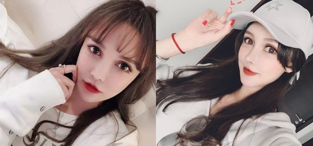 Chi 12 tỷ đồng cho 300 lần dao kéo, ngoại hình cô gái trẻ thay đổi đáng kinh ngạc-1