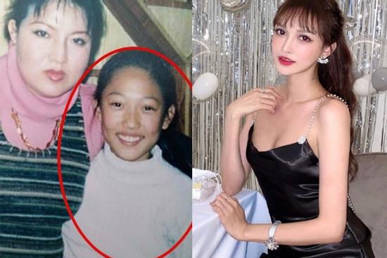 Chi 12 tỷ đồng cho 300 lần dao kéo, ngoại hình cô gái trẻ thay đổi đáng kinh ngạc