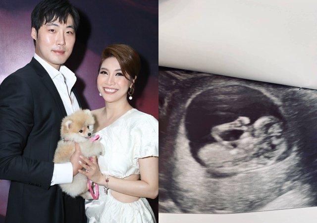 Pha Lê và nỗi đau 3 lần sảy thai, phải tự tiêm hormone vào bụng vì khát con ở tuổi 33-1