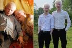 Cuộc sống thay đổi khó tin của cặp song sinh bạch tạng ở Hà Tĩnh sau 7 năm nổi tiếng
