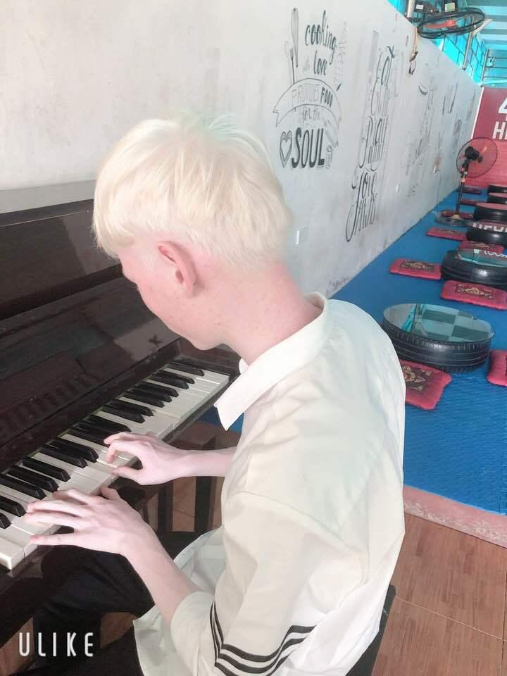 Cuộc sống thay đổi khó tin của cặp song sinh bạch tạng ở Hà Tĩnh sau 7 năm nổi tiếng-5