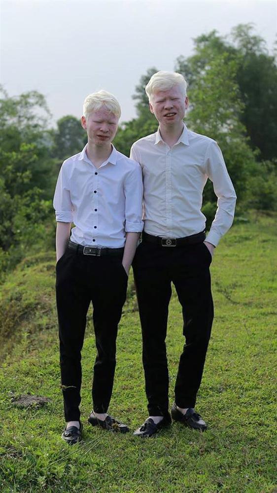 Cuộc sống thay đổi khó tin của cặp song sinh bạch tạng ở Hà Tĩnh sau 7 năm nổi tiếng-4