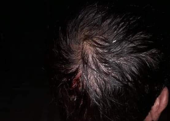 Khủng khiếp mưa đá to 7cm, có viên hình Covid-19 rơi vỡ đầu, tàn phá nhiều vùng phía Bắc-4