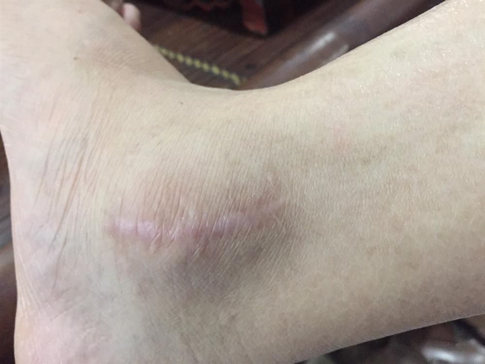 Chân dung Tiến Trắng – con nuôi bất hảo của Đường Nhuệ với những phi vụ đánh người không ghê tay-7