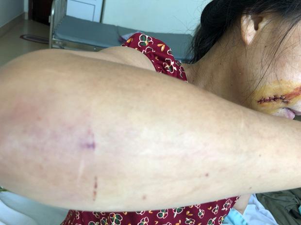 Một phụ nữ bị người tình phi công trẻ dùng mã tấu chém gục, kéo ra giữa sân lột đồ-1