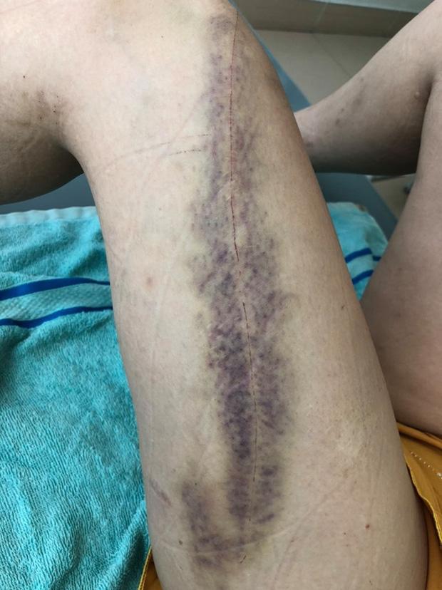 Một phụ nữ bị người tình phi công trẻ dùng mã tấu chém gục, kéo ra giữa sân lột đồ-2