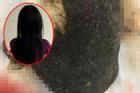 Kinh hoàng: Bé gái 11 tuổi ở Hà Nội có khối u lớn toàn... tóc trong dạ dày