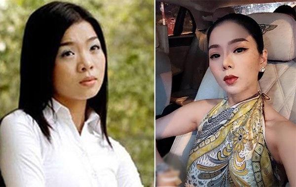 Người nổi tiếng từng gặp biến chứng sau dao kéo, có người phải sống mãi với gương mặt đáng sợ-5