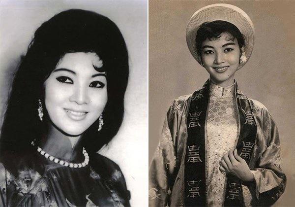 Người nổi tiếng từng gặp biến chứng sau dao kéo, có người phải sống mãi với gương mặt đáng sợ-18