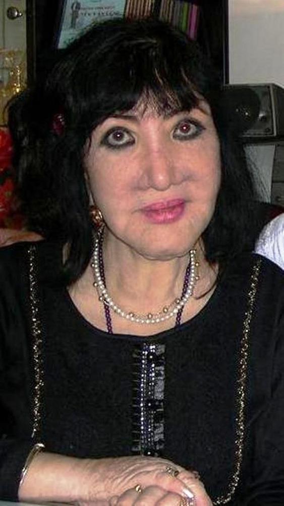 Người nổi tiếng từng gặp biến chứng sau dao kéo, có người phải sống mãi với gương mặt đáng sợ-19