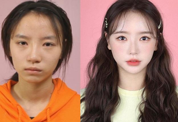 Han Areum Songee (sinh năm 1993) là hot girl nổi tiếng với hơn 400.000 lượt follow Instagram cá nhân. Cô nàng cũng là một trong số ít người đẹp tại xứ củ sâm thẳng thắn thừa nhận việc từng phẫu thuật thẩm mỹ để cải thiện nhan sắc.