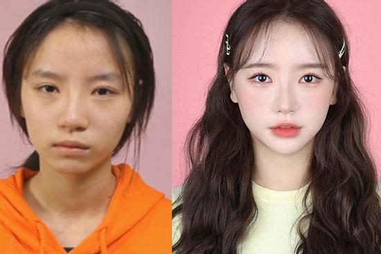 Nhan sắc mờ nhạt của hotgirl đình đám xứ Hàn trước khi dao kéo