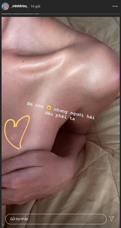 Minh Triệu phơi nắng ai ngờ da đã không đẹp lại còn bong tróc đáng thương-1