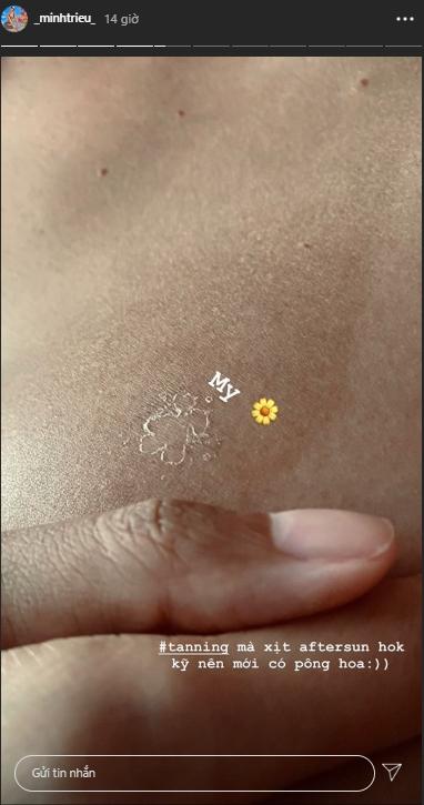 Minh Triệu phơi nắng ai ngờ da đã không đẹp lại còn bong tróc đáng thương-2