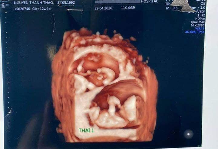 Chỉ 10 ngày cuối tháng 4, showbiz Việt rộn ràng với hàng loạt tin vui mỹ nhân bầu bí-2