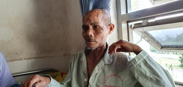 Vụ nghi án giành đất, cha già bị rạch nát đầu ở Phú Yên: Bắt giam cháu nội-1